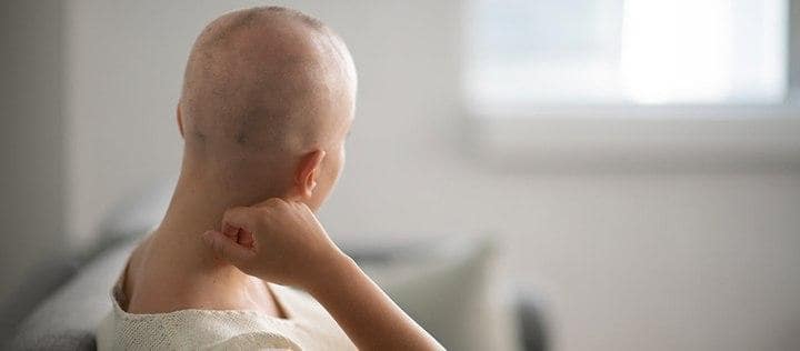 ریزش مو در بیماران سرطانی